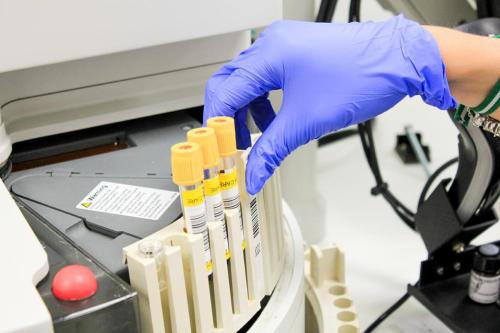 Laboratorio análisis clínicos Marbella